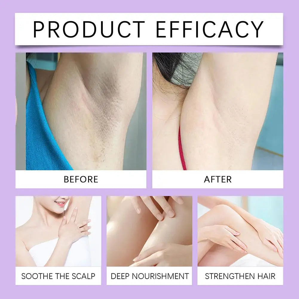Cyperus Rotundus Skin Serum Natural Hair Removal Oil Non-Irritating Safe Women Body Hair Removal Liquid Hair Growth Inhibitor